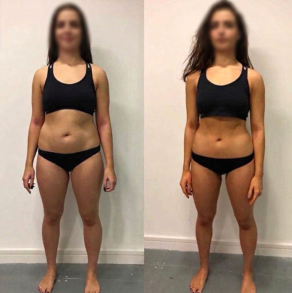 Linda before and after transformation